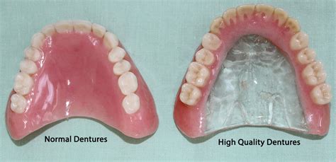 what are good quality dentures made of